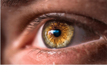 Hazel eyes: What determines hazel eye color?